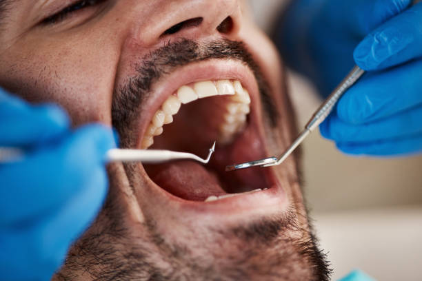 Best Cracked Tooth Emergency Dentist  in North Hornell, NY